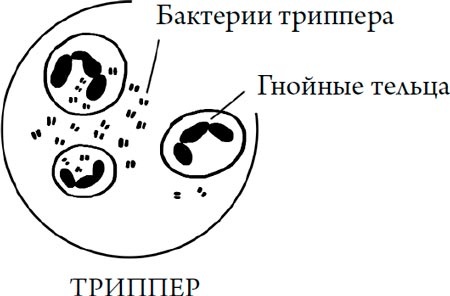 Человек Противный Человек Противный