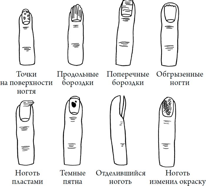 Человек Противный Человек Противный