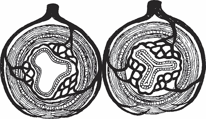 Геморрой. Излечение без операции Геморрой. Излечение без операции