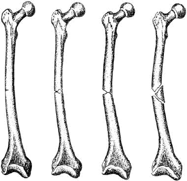 Человек в экстремальной ситуации Человек в экстремальной ситуации