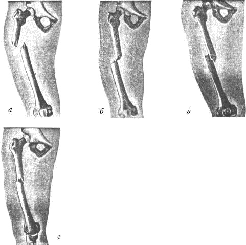 Человек в экстремальной ситуации Человек в экстремальной ситуации
