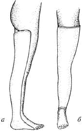 Человек в экстремальной ситуации Человек в экстремальной ситуации