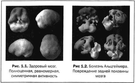 Великолепный мозг в любом возрасте Великолепный мозг в любом возрасте