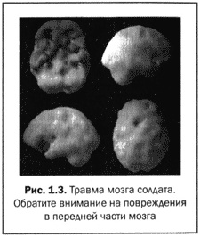 Великолепный мозг в любом возрасте Великолепный мозг в любом возрасте