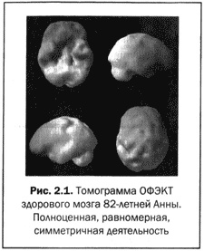 Великолепный мозг в любом возрасте Великолепный мозг в любом возрасте