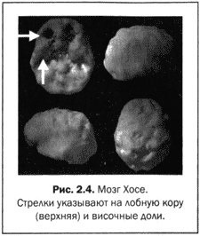 Великолепный мозг в любом возрасте Великолепный мозг в любом возрасте