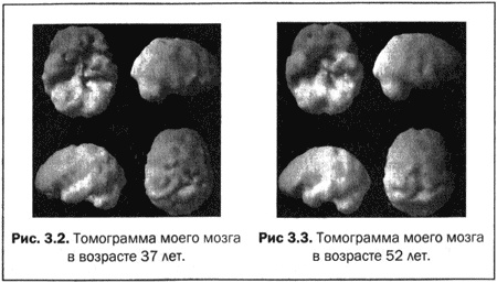 Великолепный мозг в любом возрасте Великолепный мозг в любом возрасте