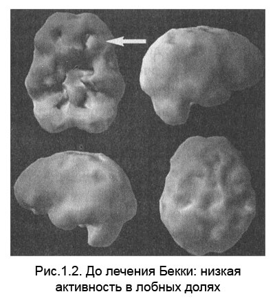 Измени свой мозг - изменится и тело! Измени свой мозг - изменится и тело!