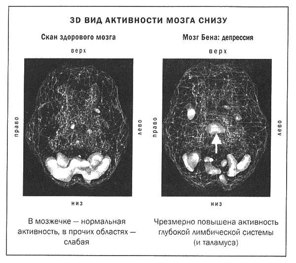 Мозг и душа. Новые открытия о влиянии мозга на характер, чувства, эмоции Мозг и душа. Новые открытия о влиянии мозга на характер, чувства, эмоции
