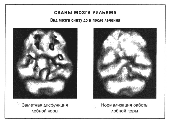 Мозг и душа. Новые открытия о влиянии мозга на характер, чувства, эмоции Мозг и душа. Новые открытия о влиянии мозга на характер, чувства, эмоции
