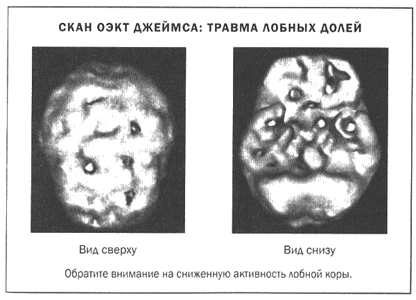 Мозг и душа. Новые открытия о влиянии мозга на характер, чувства, эмоции Мозг и душа. Новые открытия о влиянии мозга на характер, чувства, эмоции