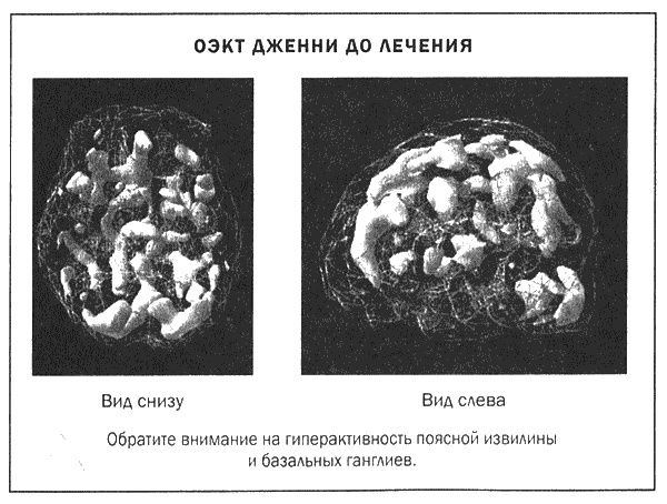 Мозг и душа. Новые открытия о влиянии мозга на характер, чувства, эмоции Мозг и душа. Новые открытия о влиянии мозга на характер, чувства, эмоции