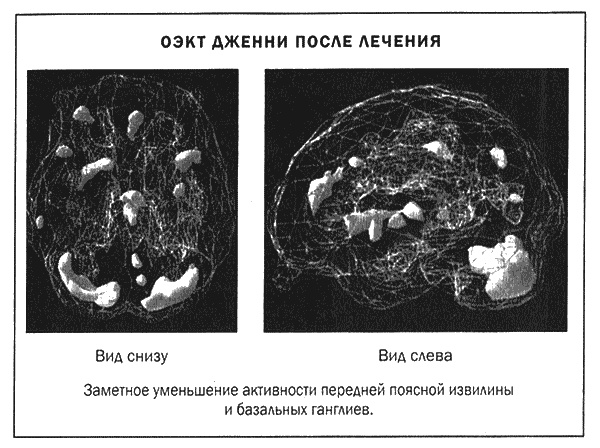 Мозг и душа. Новые открытия о влиянии мозга на характер, чувства, эмоции Мозг и душа. Новые открытия о влиянии мозга на характер, чувства, эмоции