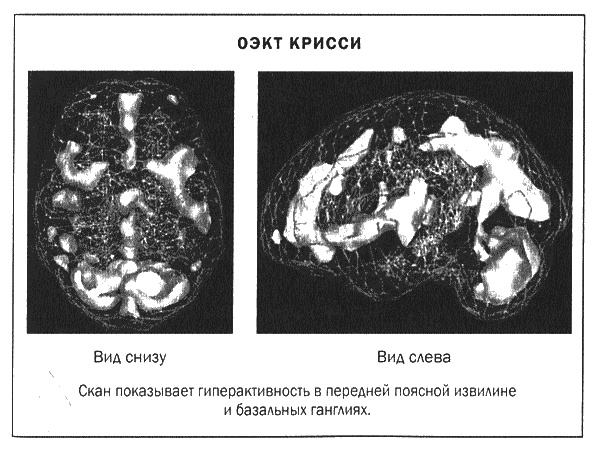Мозг и душа. Новые открытия о влиянии мозга на характер, чувства, эмоции Мозг и душа. Новые открытия о влиянии мозга на характер, чувства, эмоции