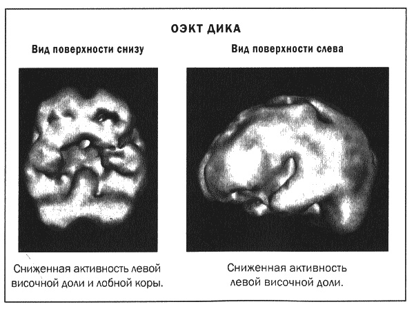 Мозг и душа. Новые открытия о влиянии мозга на характер, чувства, эмоции Мозг и душа. Новые открытия о влиянии мозга на характер, чувства, эмоции