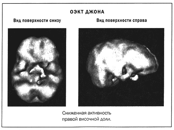 Мозг и душа. Новые открытия о влиянии мозга на характер, чувства, эмоции Мозг и душа. Новые открытия о влиянии мозга на характер, чувства, эмоции