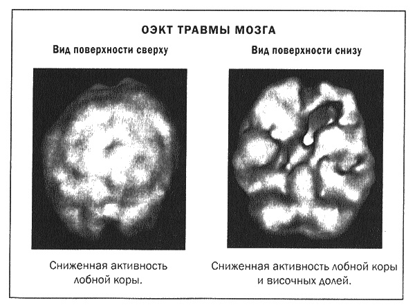 Мозг и душа. Новые открытия о влиянии мозга на характер, чувства, эмоции Мозг и душа. Новые открытия о влиянии мозга на характер, чувства, эмоции