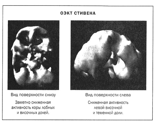 Мозг и душа. Новые открытия о влиянии мозга на характер, чувства, эмоции Мозг и душа. Новые открытия о влиянии мозга на характер, чувства, эмоции