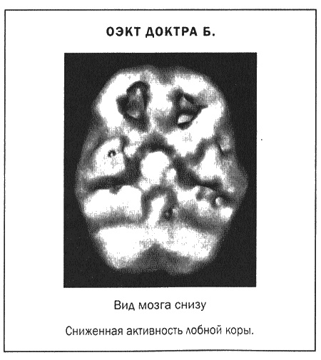 Мозг и душа. Новые открытия о влиянии мозга на характер, чувства, эмоции Мозг и душа. Новые открытия о влиянии мозга на характер, чувства, эмоции