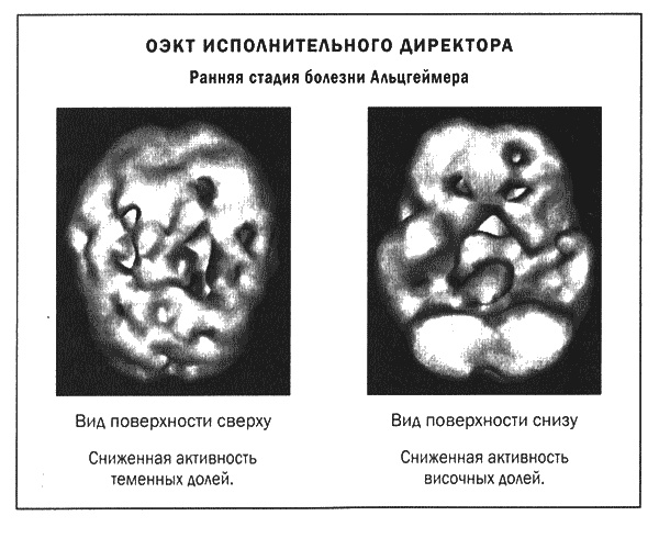 Мозг и душа. Новые открытия о влиянии мозга на характер, чувства, эмоции Мозг и душа. Новые открытия о влиянии мозга на характер, чувства, эмоции
