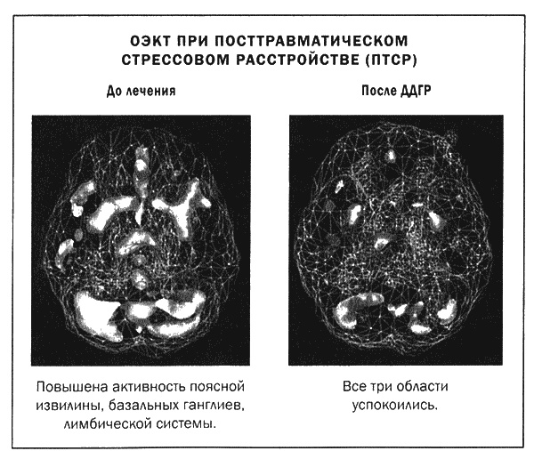 Мозг и душа. Новые открытия о влиянии мозга на характер, чувства, эмоции Мозг и душа. Новые открытия о влиянии мозга на характер, чувства, эмоции