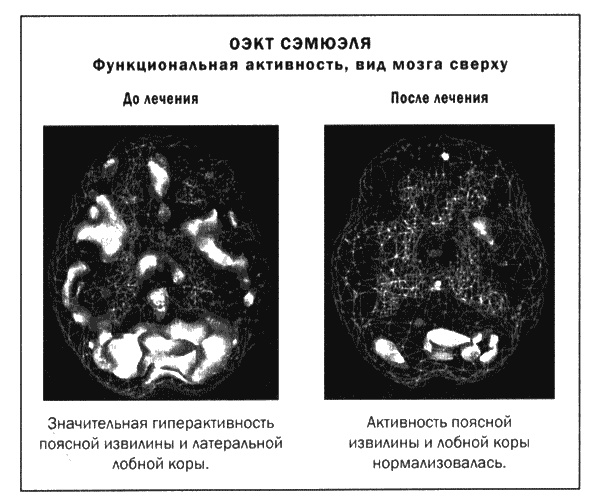 Мозг и душа. Новые открытия о влиянии мозга на характер, чувства, эмоции Мозг и душа. Новые открытия о влиянии мозга на характер, чувства, эмоции