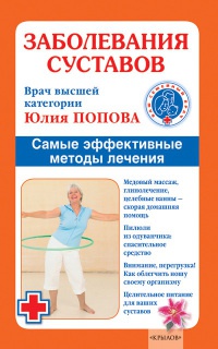 Заболевания суставов. Самые эффективные методы лечения - Юлия Попова - Читать книги онлайн | Слушать аудиокниги онлайн | Электронная библиотека books-lib.com