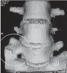 Остеохондроз для профессионального пациента Остеохондроз для профессионального пациента
