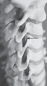 Остеохондроз для профессионального пациента Остеохондроз для профессионального пациента