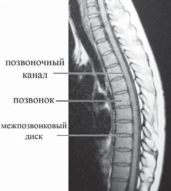 Остеохондроз для профессионального пациента Остеохондроз для профессионального пациента