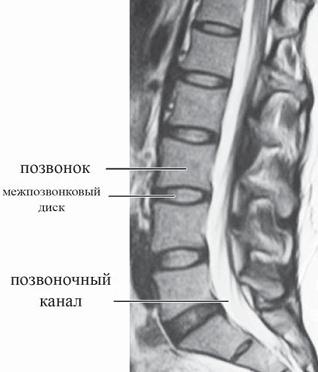 Остеохондроз для профессионального пациента Остеохондроз для профессионального пациента
