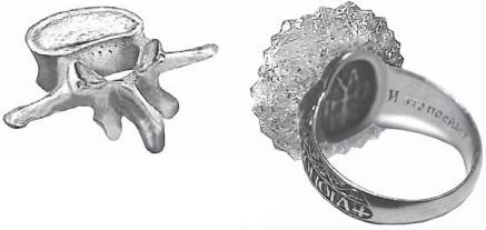 Остеохондроз для профессионального пациента Остеохондроз для профессионального пациента