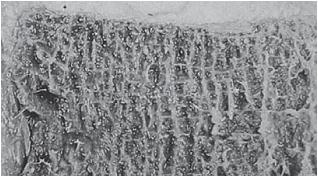 Остеохондроз для профессионального пациента Остеохондроз для профессионального пациента