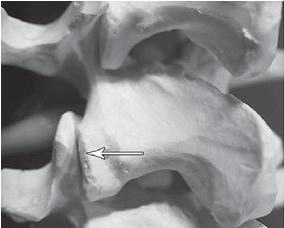 Остеохондроз для профессионального пациента Остеохондроз для профессионального пациента