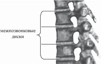 Остеохондроз для профессионального пациента Остеохондроз для профессионального пациента