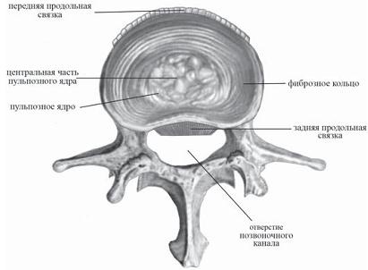 Остеохондроз для профессионального пациента Остеохондроз для профессионального пациента