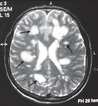 Остеохондроз для профессионального пациента Остеохондроз для профессионального пациента