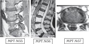 Остеохондроз для профессионального пациента Остеохондроз для профессионального пациента