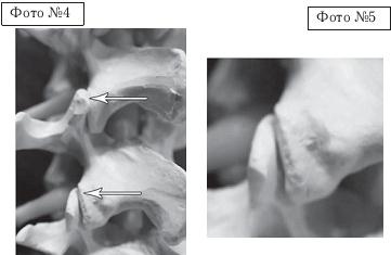 Остеохондроз для профессионального пациента Остеохондроз для профессионального пациента