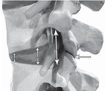 Остеохондроз для профессионального пациента Остеохондроз для профессионального пациента