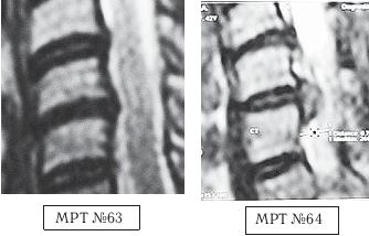 Остеохондроз для профессионального пациента Остеохондроз для профессионального пациента