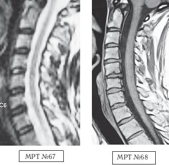 Остеохондроз для профессионального пациента Остеохондроз для профессионального пациента