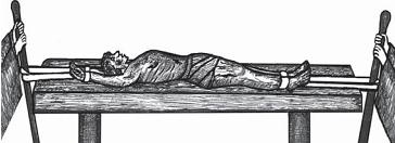 Остеохондроз для профессионального пациента Остеохондроз для профессионального пациента