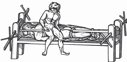 Остеохондроз для профессионального пациента Остеохондроз для профессионального пациента