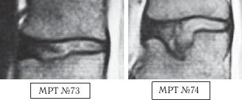Остеохондроз для профессионального пациента Остеохондроз для профессионального пациента