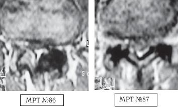 Остеохондроз для профессионального пациента Остеохондроз для профессионального пациента