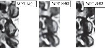 Остеохондроз для профессионального пациента Остеохондроз для профессионального пациента