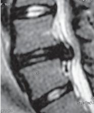 Остеохондроз для профессионального пациента Остеохондроз для профессионального пациента