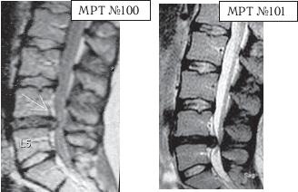 Остеохондроз для профессионального пациента Остеохондроз для профессионального пациента
