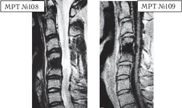 Остеохондроз для профессионального пациента Остеохондроз для профессионального пациента